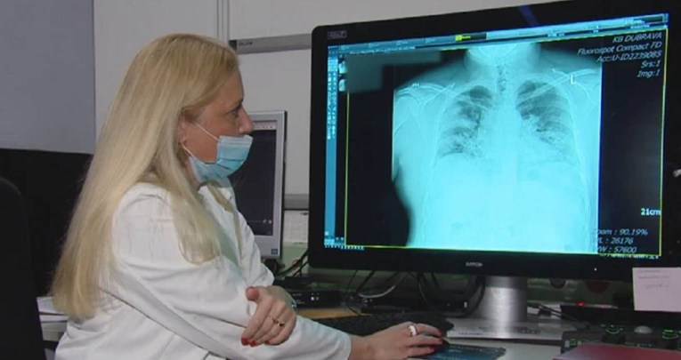 rendgenska snimka pluća